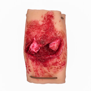 Симулатор на фрактура на предмишницата TactiFlesh®